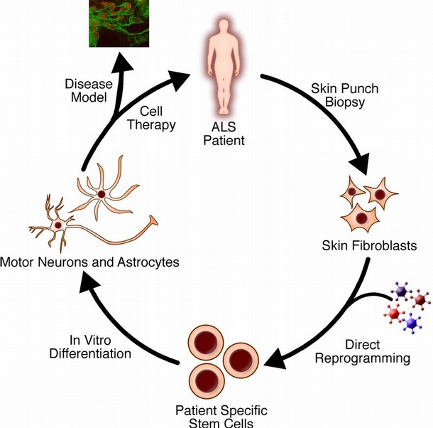  Lou Gehrig's Disease