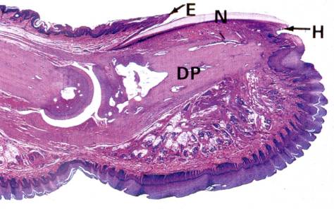 Finger nail distal phalanx