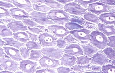 Integumentary System Micrograph of  keratinocytes stratum spinosum